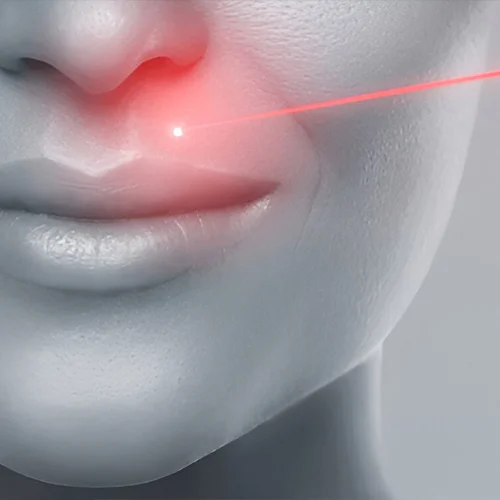 Laser