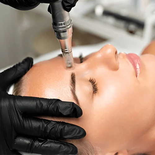 Microneedling and Microchannelling
